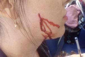 В России опасно ходить в банк: постоянной клиентке проткнули щеку шариковой ручкой 