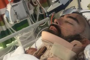 Упал головой на бетон: Житель Австралии на лету спас выпавшего с балкона сына