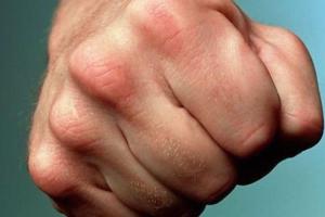 В Закарпатской области цыгане жестоко избили участника АТО