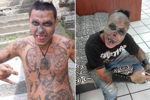 В Колумбии 22-летний парень отрезал себе нос и уши, чтобы стать похожим на скелет 