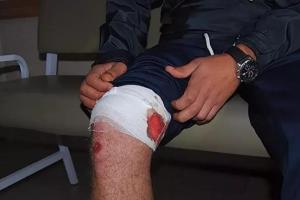 Россиянин на спор прострелил себе ногу