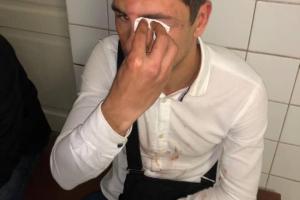 Лидера молодежного крыла партии Ляшко избили в Киеве: опубликовано фото