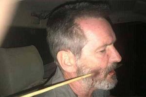 В Кении рейнджер получил стрелой в лицо, перекусил ее и вынул