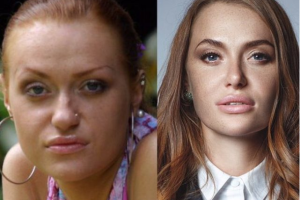 Участница группы "НеАнгелы" показала себя до пластики