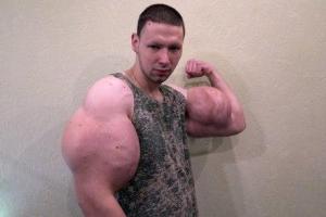 Врачи удалили "руки-базуки" блогеру Кириллу Терешину