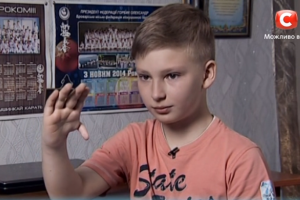 На проекте "Я стесняюсь своего тела" юному пациенту "пересадили" палец