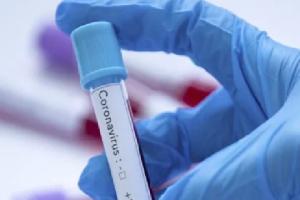 В Донецкой области подтвержден второй случай заражения COVID-19 