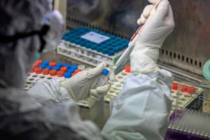 Дорогой коронавирус: стало известно, сколько стоит лечение больного COVID-19