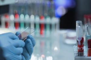 Стоимость теста на коронавирус и за чей счет проходит лечение: Гайдай ответил на важные вопросы