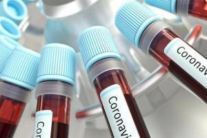 Приріст захворюваності COVID-19 на Луганщині відбувається через приїжджих з РФ - Гайдай