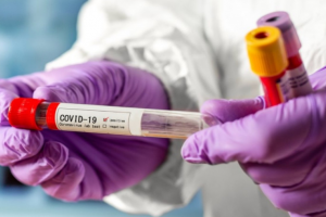 На Луганщині зафіксовано 44 нових випадки COVID-19: карта поширення