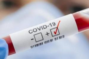На Луганщине выявили 19 новых больных COVID-19