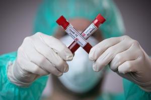 COVID-19 у Луганській області: зафіксовано новий смертельний випадок