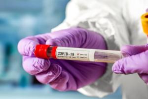 ВОЗ зарегистрировала тесты на COVID-19, результаты которого известны уже через несколько минут