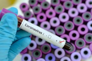 На Луганщине занято 74% коек для больных COVID-19, - МОЗ