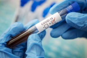 COVID-19 і посилення карантину: головні новини регіону за 19 жовтня