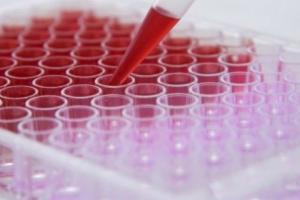 На Луганщині стрімко поширюється COVID-19: зафіксовано понад 130 нових випадків