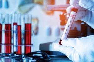 Жертвы коронавируса и эпидемическая ситуация в области: главные новости региона за 28 ноября