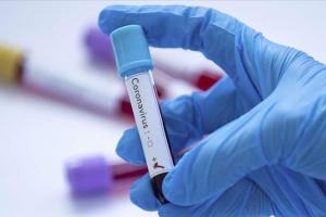 В Украине новый коронавирусный рекорд: за сутки выявлено 11,7 тысячи новых больных