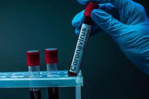 В Луганской области лабораторно подтверждено 25 новых случаев COVID-19