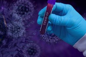 В Украине подтвердили 3915 новых случаев COVID-19