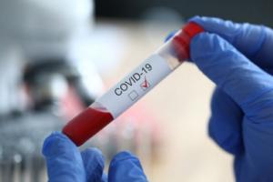 На Луганщине подтверждено еще 22 случая COVID-19