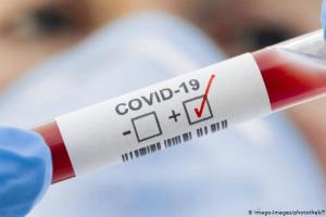 У Луганській області лабораторно підтверджено 23 нових випадки COVID-19