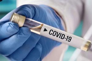 На Луганщине лабораторно подтверждено 72 новых случая COVID-19