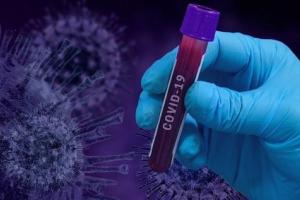 В Украине подтверждено 6,5 тысяч новых случаев COVID-19