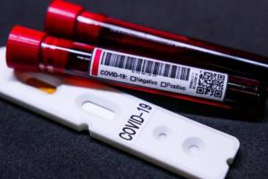 Які області стануть епіцентром коронавірусу в Україні: прогноз НАН