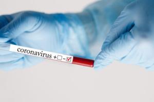 В Україні зафіксовано 11 680 нових випадків COVID-19