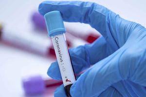 На Луганщине резко возросла заболеваемость COVID-19: за сутки выявлен 321 новый случай