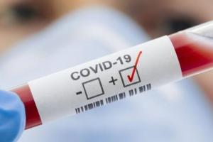 В Україні зафіксовано 285 нових випадків COVID-19