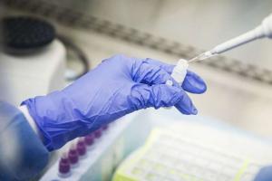 У Луганській області підтверджено 22 нових випадки COVID-19