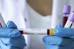 В Бельгии умерла женщина, заразившаяся одновременно двумя штаммами COVID-19