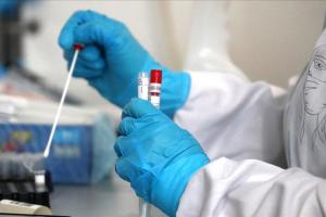 В Украине зафиксировано 213 новых случаев COVID-19
