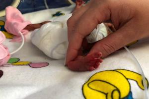 Украинским врачам удалось спасти ребенка, который родился с весом 540 грамм (фото)