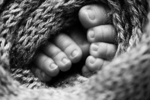 Дитина народилася одразу "старою" через рідкісну хворобу: фото