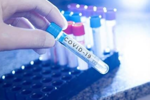 На Луганщине подтверждено 27 новых случаев COVID-19