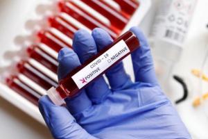 В Україні зафіксовано майже 8 тисяч нових випадків COVID-19
