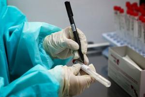 На Луганщині зафіксовано 9 нових випадків COVID-19