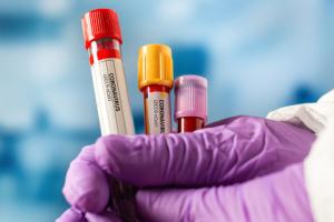 На Луганщині зафіксовано 35 нових випадків COVID-19