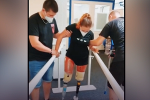 Медсестра з Лисичанська, що підірвалася на ворожій міні, вчиться ходити на протезах