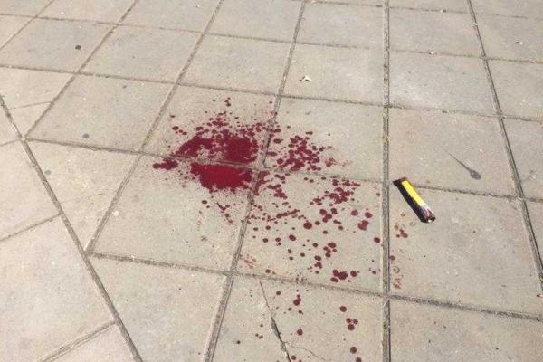 В Киеве на "Марше равенства" пролилась первая кровь, ранен работник МВД В Киеве на "Марше равенства" пролилась первая кровь, ранен работник МВД