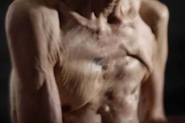 Старый японец показал шрамы, полученные "на память" о взрыве атомной бомбы Старый японец показал шрамы, полученные "на память" о взрыве атомной бомбы