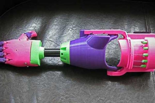 Девочка-инвалид получила от волонтеров бесценный подарок - 3D-протез руки Девочка-инвалид получила от волонтеров бесценный подарок - 3D-протез руки