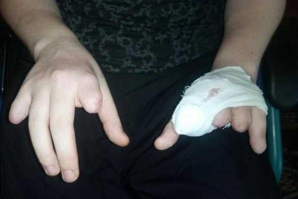 Использовали и выбросили: боевики "ДНР" отказалась от своей покалеченной снайперши  Использовали и выбросили: боевики "ДНР" отказалась от своей покалеченной снайперши