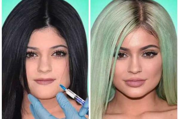 В Сети появился ролик в котором видно как пластические хирурги поработали над лицами сестер Кардашьян 