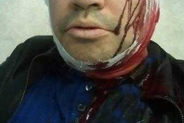 В Харькове началась "зачистка" кандидатов в мэры? В Харькове началась "зачистка" кандидатов в мэры?