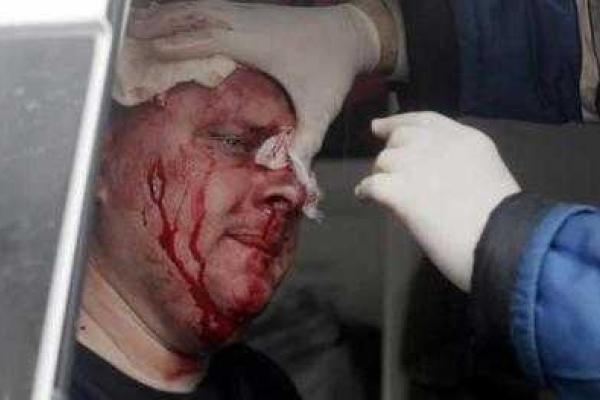 Начальником ГУ Нацполиции в Киеве назначен бывший начальник милиции Горловки Андрей Крищенко Начальником ГУ Нацполиции в Киеве назначен бывший начальник милиции Горловки Андрей Крищенко